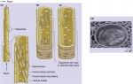 Células de conducción del xilema en angiospermas